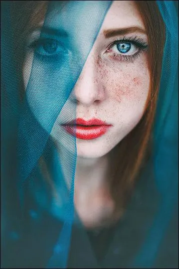 Comment est appelée la rousseur ?