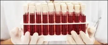 Sachant qu'elle peut varier d'un individu à un autre, selon la corpulence et le sexe, quelle quantité de sang le corps humain contient-il au maximum ?