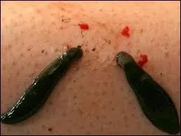 De nos jours, dans quel domaine les sangsues peuvent-elles être d'un usage bénéfique ?