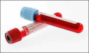 Dans une prise de sang, il est possible de doser :