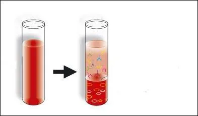 Pour séparer le sérum et les cellules du sang, il faut :
