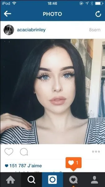 Que pense Rachel de sa chirurgie du visage ?