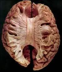 Pour vous tout va bien ! 200 000 millions de fibres nerveuses permettent de communiquer entre les hémisphères du cerveau. Quel nom porte ce faisceau d'axones ?