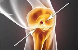 Pourquoi les cartilages ont-ils une guérison lente ?