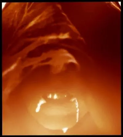 Je retournai donc en ce lieu, mon premier royaume, en compagnie de mon sorcier d'escorte. Mais ces conditions de vie, ce voyage, ont très vite eu raison de ma santé physique. Je dus recourir à un traitement de fortune en m'abreuvant