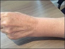 C'est dans le poignet que l'on trouve cet os appelé « l'astragale ».