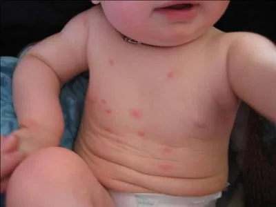 La puce est un "ectoparasite", c'est à dire : ...