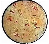 Quelle fut la cause de la mort de Robert Guiscard, en 1085, sur l'île de Céphalonie ?