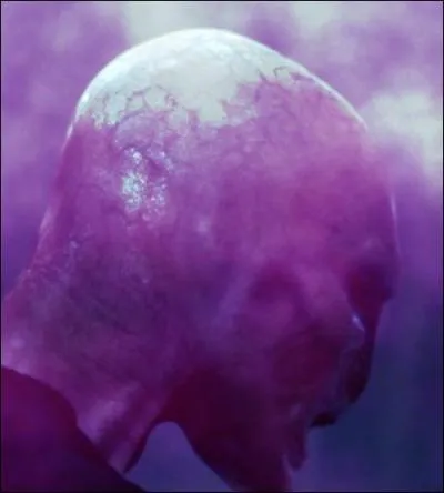 _______________ Chapitre 2 : Le nouveau look Voldemort _______________

« Les yeux écarlates et grands ouverts, le nez plat, avec deux fentes en guise de narines, à la manière ___A___ Il contempla ses mains, semblables à ___B___ , puis caressa de ses longs doigts blanchâtres sa poitrine, ses bras, son visage. Ses yeux rouges, aux pupilles verticales comme celles ___C___ . »