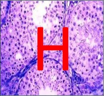H comme Histologie : quel tissu biologique se compose de cellule Schwann ?