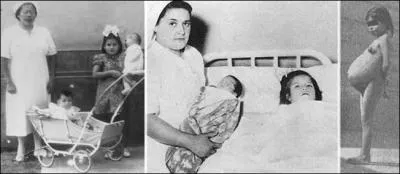 La plus jeune mère de l'histoire de la médecine avait 5 ans !