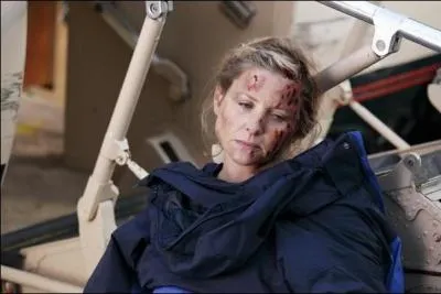 Callie se rend compte que Arizona ne pourra pas vivre si on lui laisse sa jambe. Qui lui ampute ?