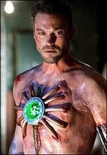 Qui a un cur artificiel en kryptonite et a été aidé par Lois Lane ?