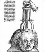 Voici un traitement encore plus vieux que la saignée : la trépanation ou craniotomie. Elle est utilisée de nos jours par les neurochirurgiens pour traiter l'hypertension intracrânienne.
De quand datent les plus anciennes traces de trépanation ?