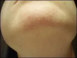 Comment dit-on "le menton" ?