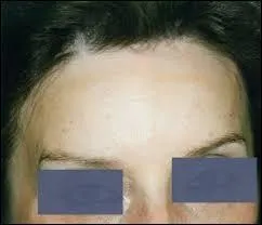 Comment dit-on "le front" ?