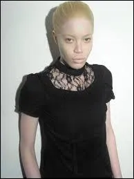 Quel est le nom de la particularité génétique qui peut donner chez certaines personnes une couleur blonde aux cheveux ?