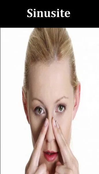 Quel est le bon remède pour soulager les sinusites ?