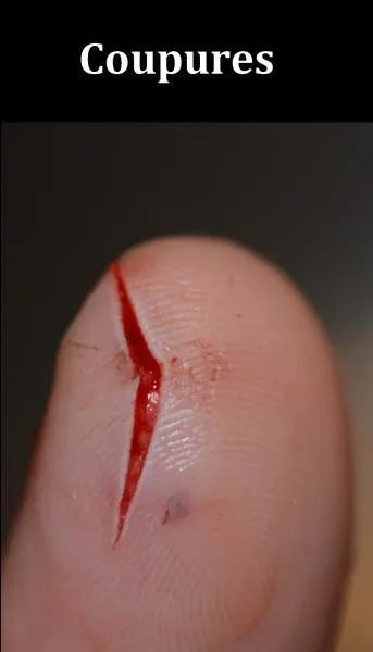 Quel est le bon remède pour soigner une coupure ?