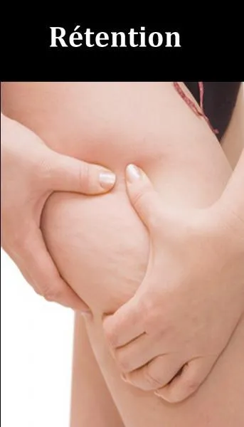 Quel est le bon remède pour soigner la rétention d'eau ?