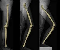 Comment s'appelle l'os du genou ?