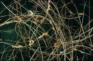 Pouah, il en a plein les cheveux ! Mais de quoi sa chevelure est-elle infestée ?