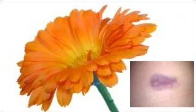 L'une des propriétés du -------- est ---------.