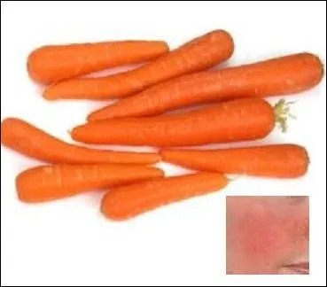 L'huile à base de carotte ne soulagera pas du coup de soleil, mais que peut-elle bien calmer ?