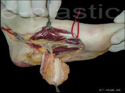 Comment s'appelle la membrane fine qui enveloppe un muscle ou un groupe de muscles ?