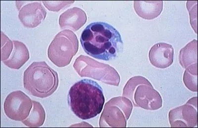 On dit que la cellule est...