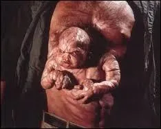 Si vous avez "quelqu'un dans la peau", cela signifie que :