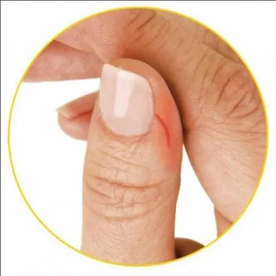 "Crevasse" ! Quel est le bon numéro du département ?