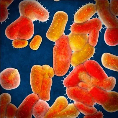 Quel est ce virus qui commence à voir sa fin arriver en 2015, qui a tant touché les gens de la photo 3 et qui m'a arraché quelques amis ?