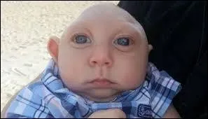 Ce bébé n'a pas...