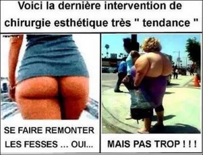 Dans quelle ville américaine, durant l'été, les femmes sont-elles autorisées à se promener seins nus dans les lieux publics ?