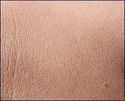 De quoi sa peau doit-elle se détacher ?