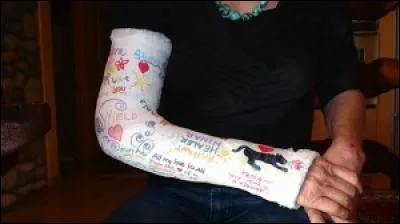 On dirait que son bras est cassé ! 
Comment dit-on "bras" en anglais ?