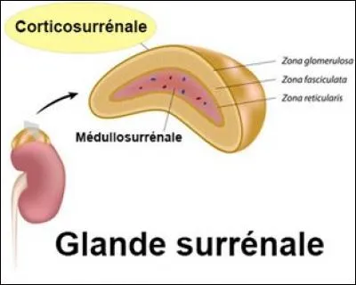 L'insuffisance surrénalienne ou :