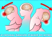 Quiz Le syndrome du bb secou