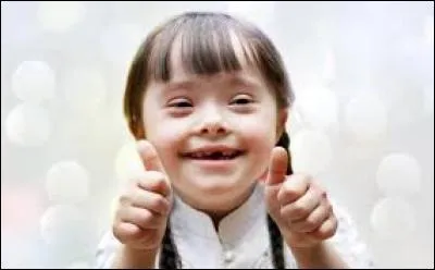 Cette maladie peut être détectée dès la grossesse, ce qui ne rend tout de même pas son traitement plus facile. Par expérience, je sais que les parents ont du mal à choisir entre avorter ou s'occuper de leur enfant, qui aura besoin d'un accompagnement spécial. Tout cela car un chromosome 21 est arrivé, en plus des deux autres.