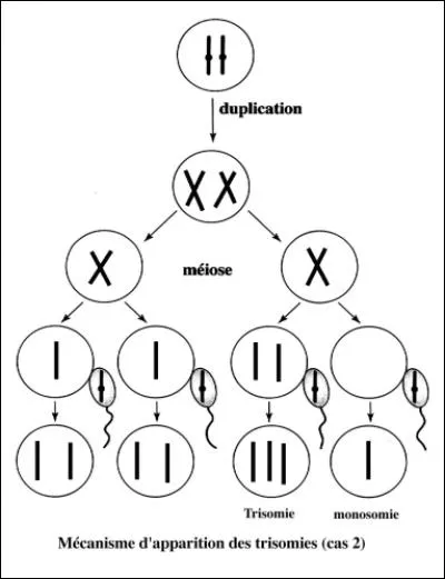 À quel moment de la division cellulaire l'anomalie de la trisomie 21 se produit-elle ?