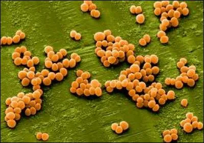 Voici des bactéries l'une d'elle est une redoutable tueuse, on l'attrape souvent à l'hôpital.