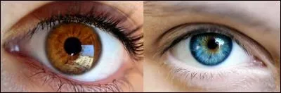 Un ami vous dit : 
« Mon pauvre ami, ton médecin te dit que tu es « emmétrope » ! Dis-moi, c'est grave » ?
Bon, soyez sympa avec votre interlocuteur, dites-lui de quoi vous souffrez !