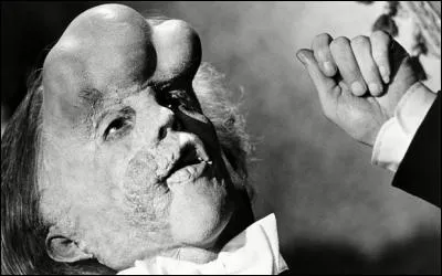 La maladie d'El&eacute;phant Man ou syndrome de Prot&eacute;e affecte les os et les tissus du corps humain en les faisant grandir d'une fa&ccedil;on incontr&ocirc;lable. Qui r&eacute;alisa ce film inoubliable " The &eacute;l&eacute;phant Man " ?