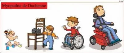 Quels sont les effets de la myopathie de Duchenne ?