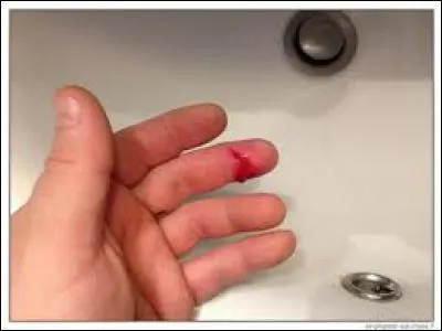 Elle s'est . le doigt en préparant son repas. (Complétez)