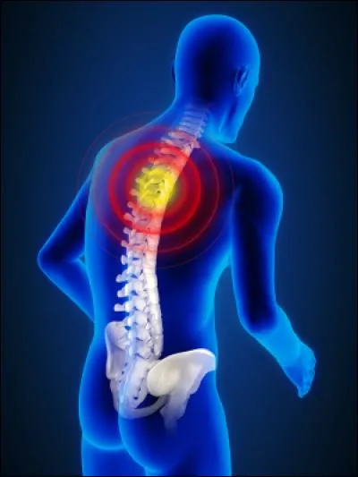 En médecine, lorsqu'on parle de SPA, de quoi parle-t-on ?