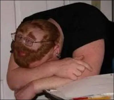 L'expression "Avoir mal aux cheveux", s'emploie pour traduire :