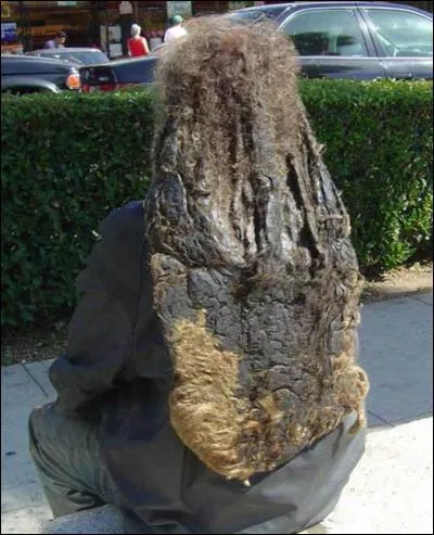 Normalement, lequel de ces éléments ne trouve-t-on pas dans un cuir chevelu ?