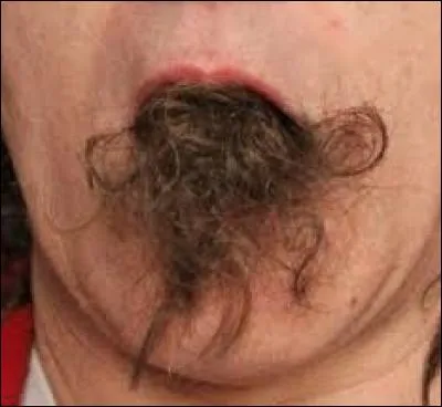 Si vous zozotez, on dit communément que vous avez :